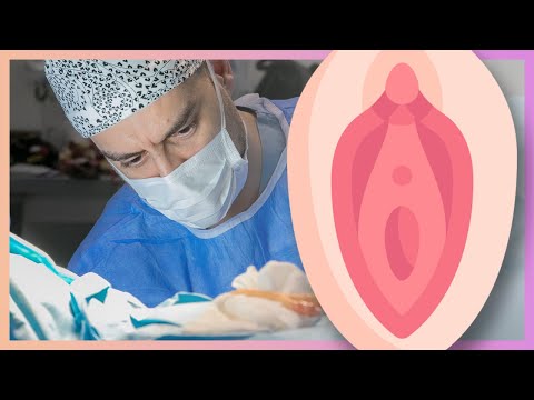 Her Detayıyla Labioplasti