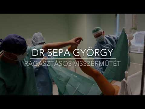 Az alsó végtagok varikózisának műtéti kezelése videó