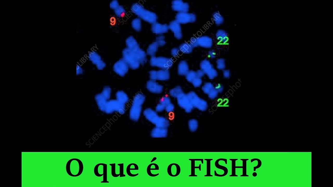 FISH - Hibridização In Situ Fluorescente - DNA Brilhante!