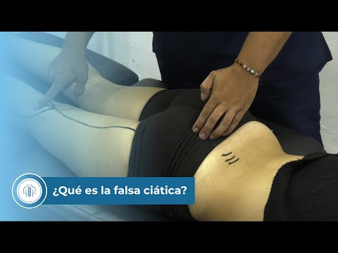 ¿Qué es la falsa ciática?