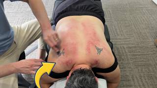 She Won't Give Up | 😢 Healing Is A Journey! "Cracking" The Toughest Lady! - Dr. Ed 💪