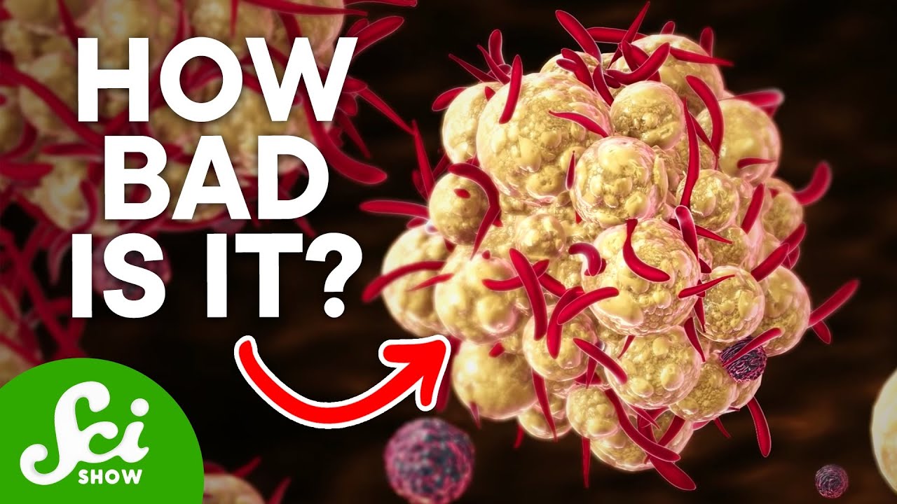 What Is Monkeypox? | SciShow News