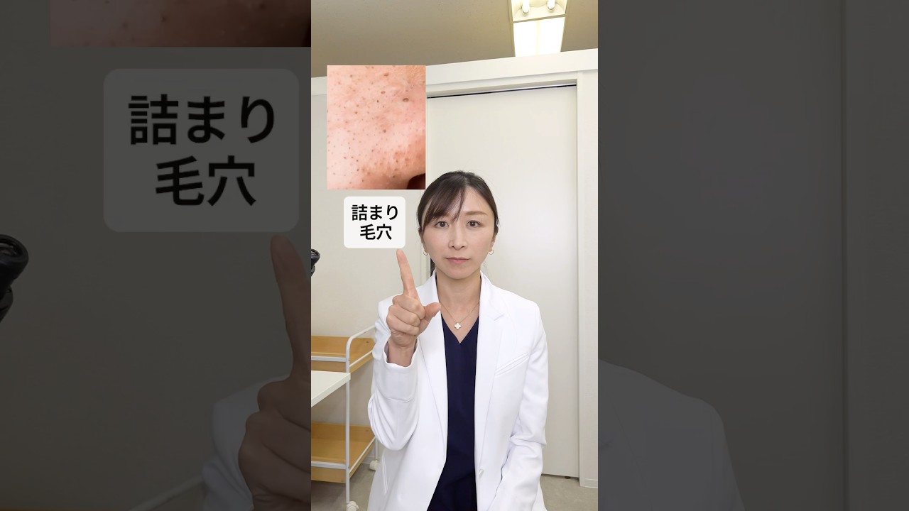 【タイプ別】毛穴目立ちにおすすめの成分