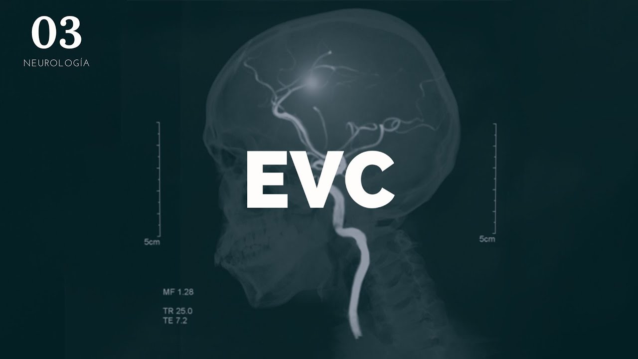 EVC - ENARM