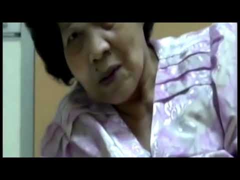 Parkinsonism with Pisa Syndrome @clinicalbro6217