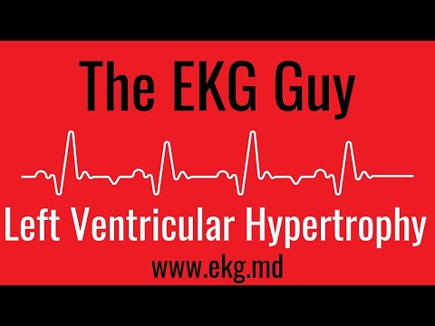 Left Ventricular Hypertrophy on EKG / ECG l The EKG Guy - www.ekg.md