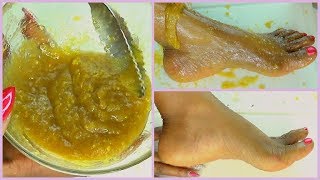 HOW TO GET BABY SOFT FEET, GET RID OF ROUGH DRY FEET + CRACKED HEELS Khichi Beauty