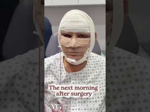 Understanding the Male Facelift Procedure in Seoul, South Korea and Early Recovery