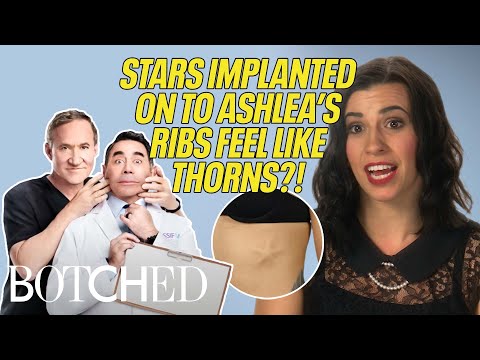 Ashlea Gets Her STAR RIB IMPLANTS Removed (Before & After) | Botched | E!