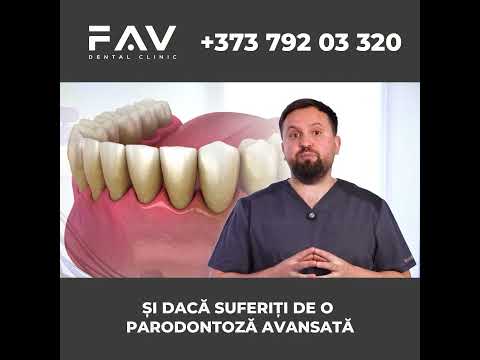 Dinții au devenit mobili? Apar infecții gingivale repetate?