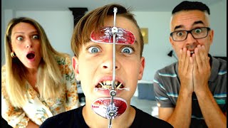 ¡NICO TIENE QUE LLEVAR ESTE APARATO EN LA CARA!