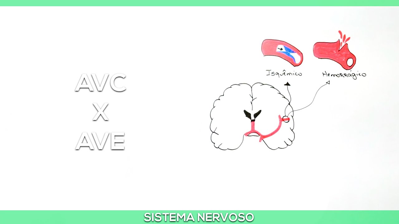 Acidentes Vasculares: AVC e AVE