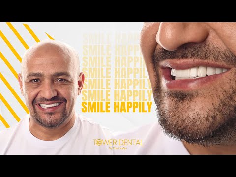 Comprehensive Guide to the Full Mouth Dental Restoration Procedure in Istanbul Turkey