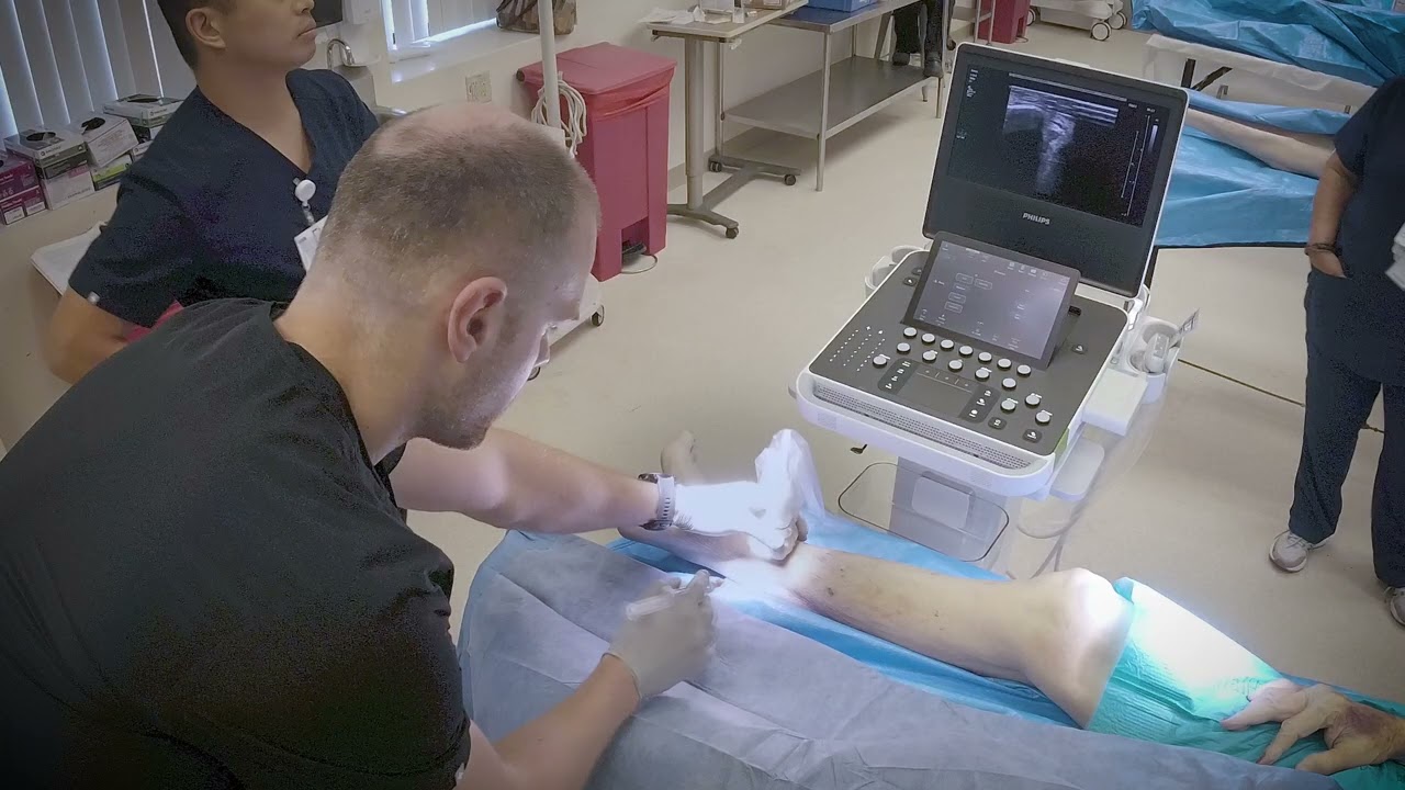 How to perform an ultrasound-guided tibial nerve block