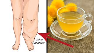 How to Get Rid of Water Retention Fast - Home Remedies For Water Retention | Water Retention |