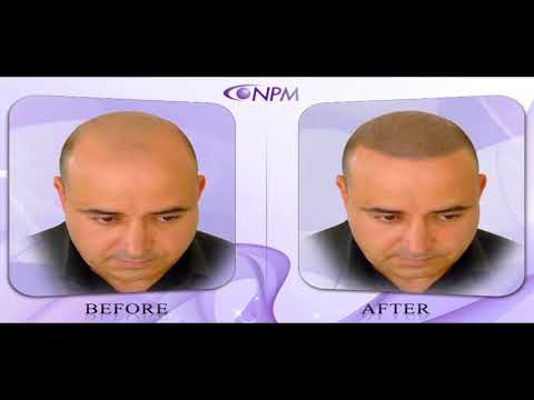 Czy jest tam centrum diagnostycznego lekarz trichologist Planeta organiczna Hair Mask skład