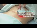 Contours Makati Trusted provider of body contouring and Vaserlipo