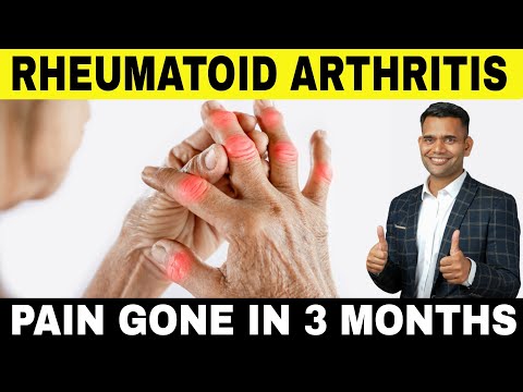 How to Cure Rheumatoid Arthritis Naturally | Best Natural Remedies That Work