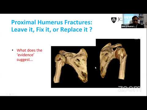Proximal Humerus Fractures: Fix it,  Replace it or Leave it alone
