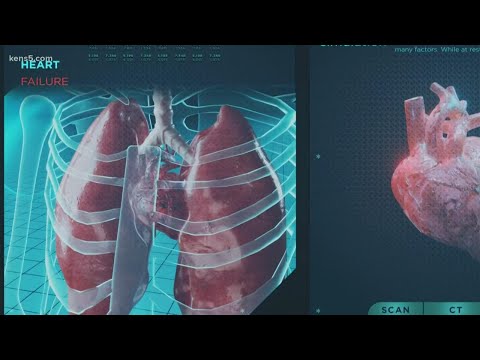 Wear the Gown: Exploring the difference between heart disease and heart failure