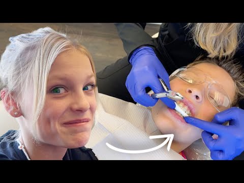 Getting my Braces Off?!