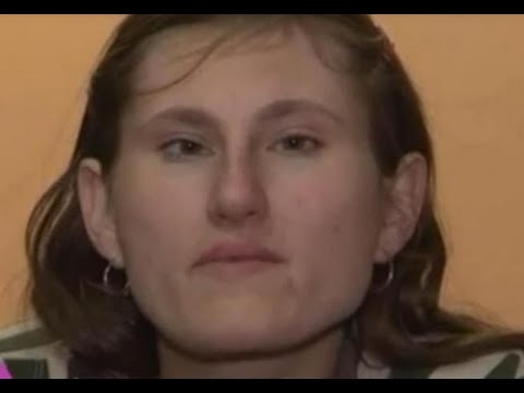 OPERACIJU KIČME ČEKALA JE CELA SRBIJA: Promena Divne DNK je OGROMNA, pogledajte kako SADA IZGLEDA