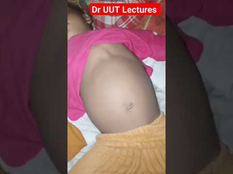 pneumonia • pneumonia  in children • pneumonia symptoms