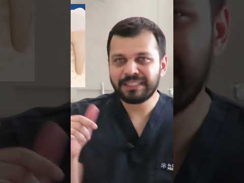 Painless Root Canal? Yes — Here is How