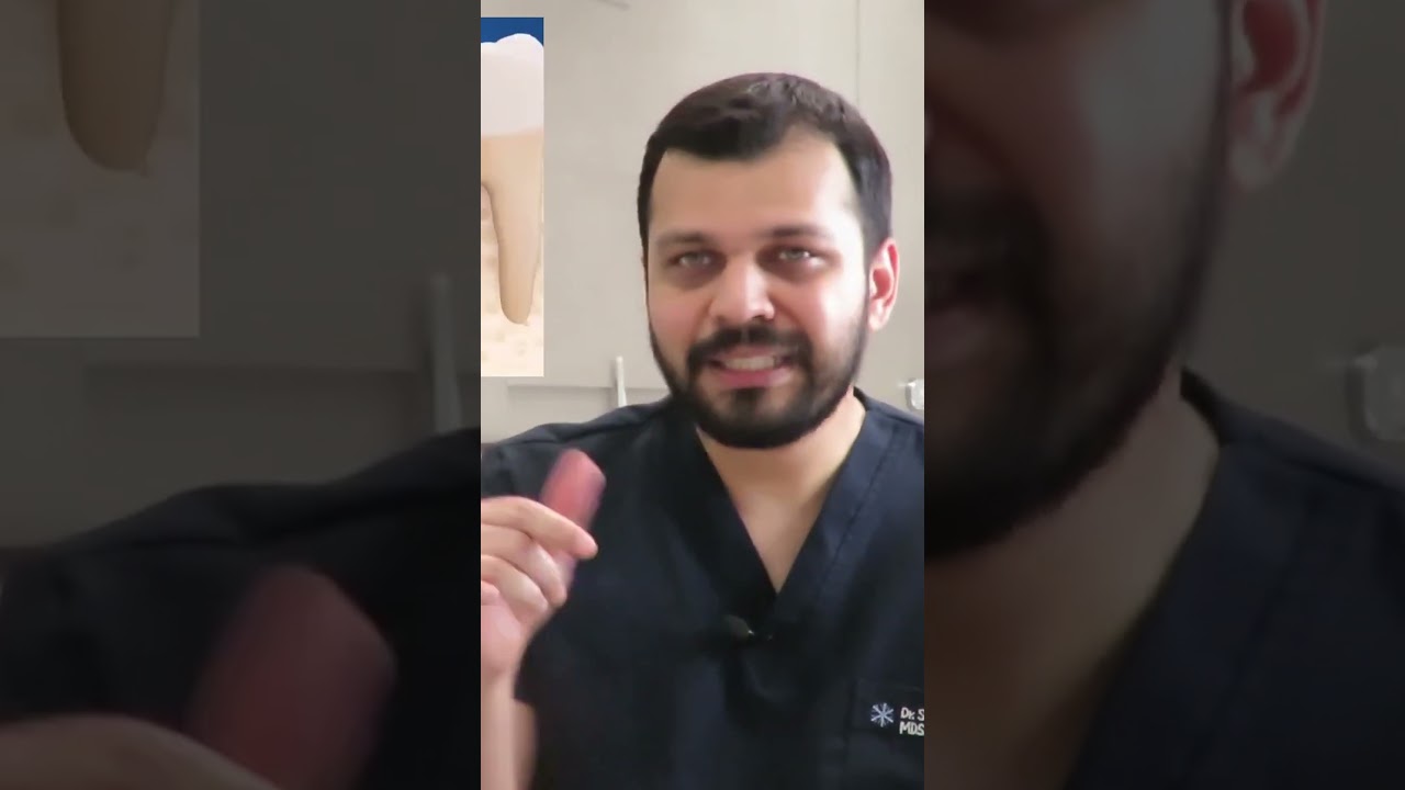 Painless Root Canal? Yes — Here is How