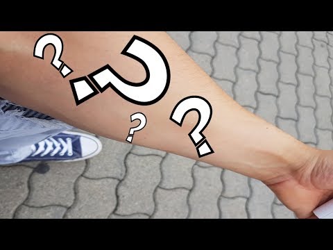 kórház a cukorbetegség kezelésében izomgyengeség fáradtság