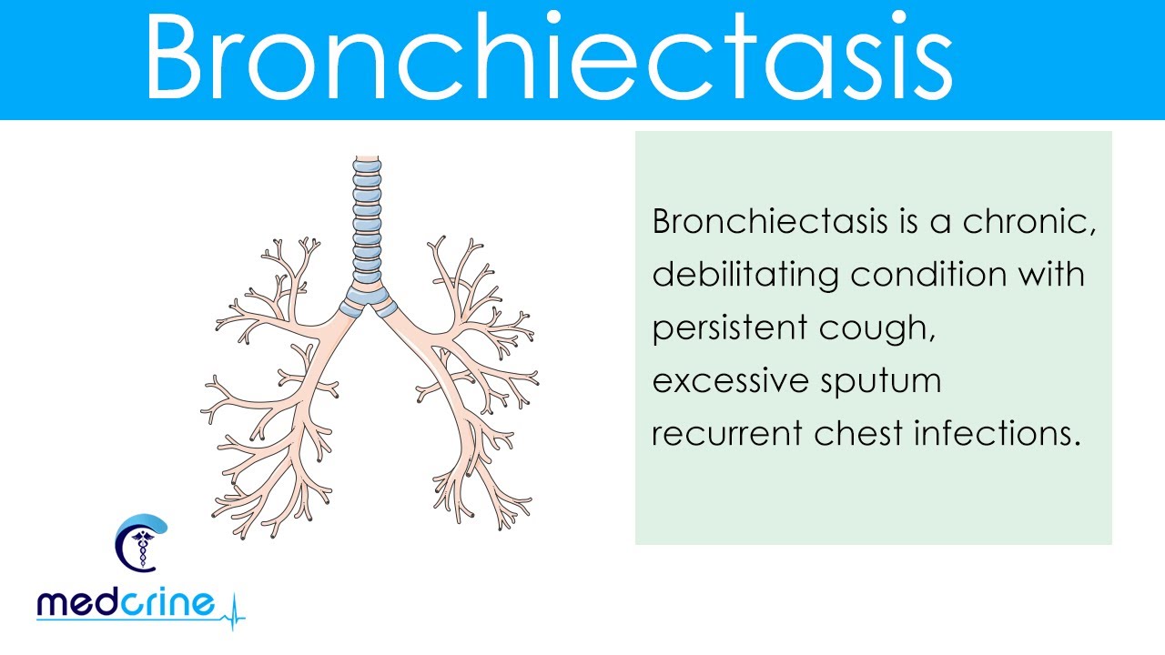 Bronchiectasis : Etiology, pathophysiology, clinical features, diagnosis and treatment - YouTube