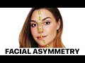 Marzia's 'Facial Asymmetry' | Surgeon Reacts