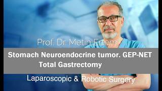 Miniaturka - Gastric Neuroendocrine Tumor. GEP-NET. Total Gastrectomy. Metin Ertem MD.FACS