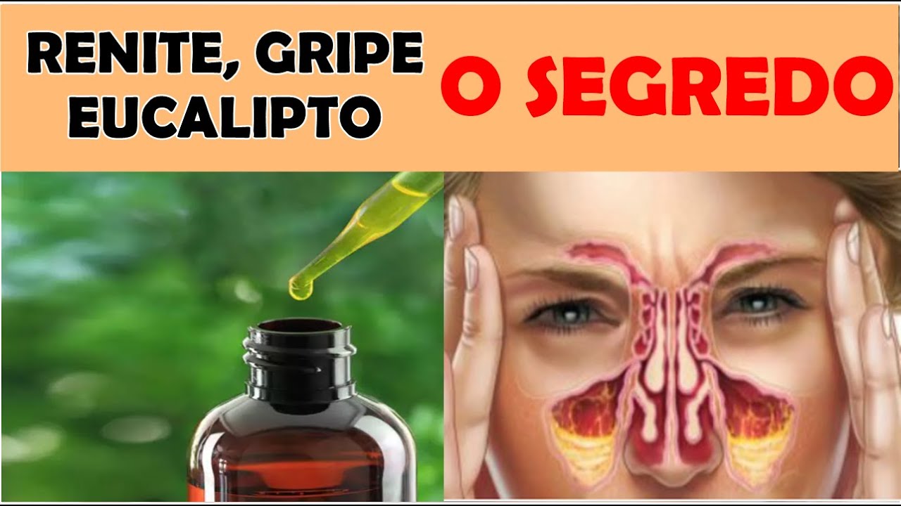 QUANTAS GOTAS DE ÓLEO DE EUCALIPTO USAR NA INALAÇÃO POR QUE EU NÃO FICO SEM ESSE ÓLEO AQUI EM CASA
