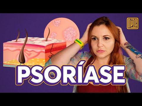 Como saber se você tem psoríase?