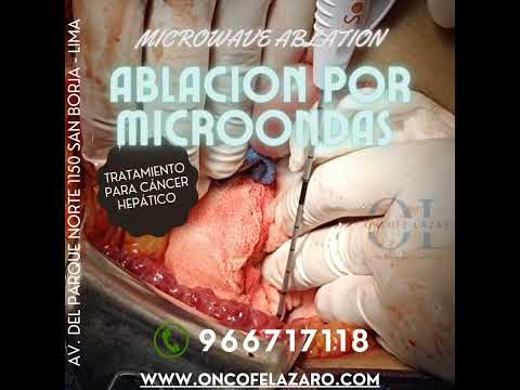 Alexander Alonso Lázaro Chumbe-30