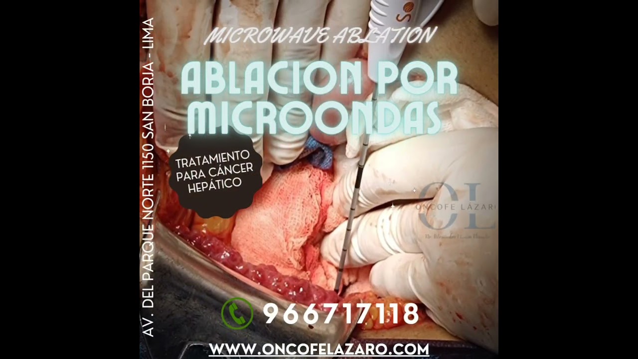 Alexander Alonso Lázaro Chumbe-30