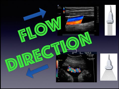 How to Determine Blood Flow Direction with Ultrasound and Doppler