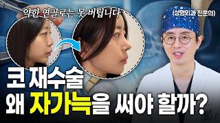 자가늑 코재수술을 많이 하는 이유,코성형 실패 원인과 재건 수술의 차이