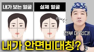 내 얼굴이 비대칭이였다고?안면비대칭에 대해 알려드립니다!!