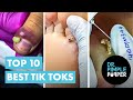 Dr Pimple Popper's Top 10 Best TikToks!