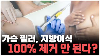 [휴먼성형외과] 가슴필러와 지방이식의 문제점은?  꼭 제거를 해야 할까?