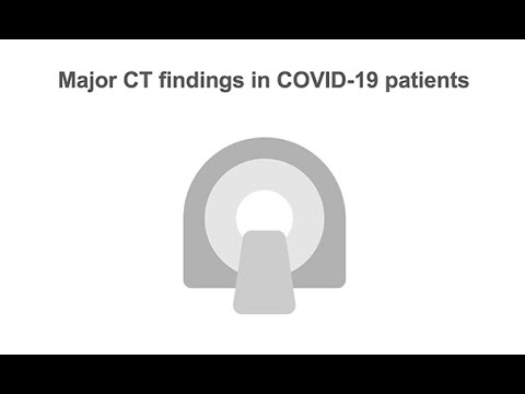 Describing chest CT findings in COVID 19