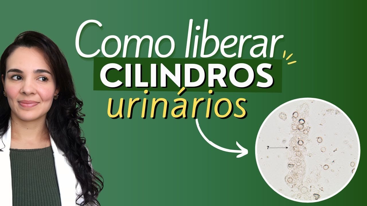 CILÍNDROS URINÁRIOS | FIM DA DÚVIDA