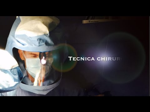 Gonfiore del ginocchio dopo lartroplastica del ginocchio Acquistare arnizin per le articolazioni