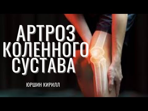 Разработка контрактуры коленного сустава! Артроз 3 степени! Лечение коленного сустава