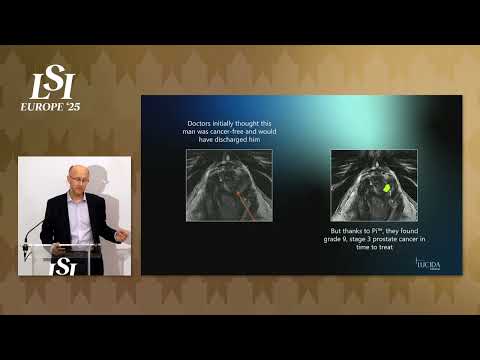 Antony Rix, Lucida Medical - AI Diagnostic Imaging For Prostate Cancer | LSI Europe '25