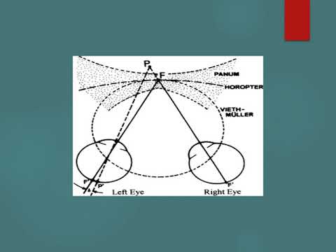 Strabismus part one by Prof Munim