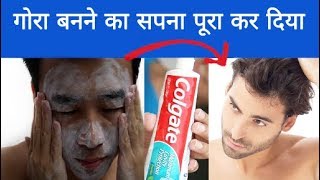 गोरा होने का तरीका  Skin Whitening || Gora Hone Ka Tarika ||  Rang Gora Karne Ke Gharelu Upay