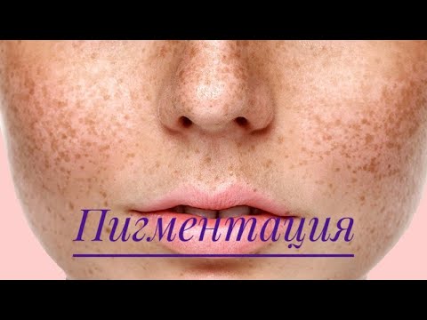Отбеливающий крем лица форум Чем можно очистить лицо от пигментных пятен